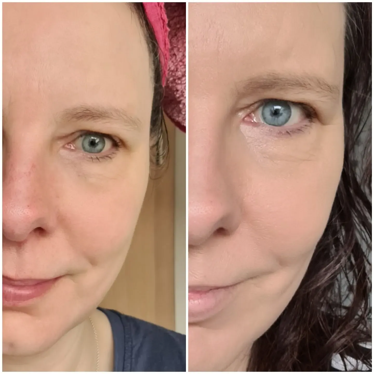 imgi_239_bbfcd5cb-6f0f-4c27-865c-33354f4c0c58